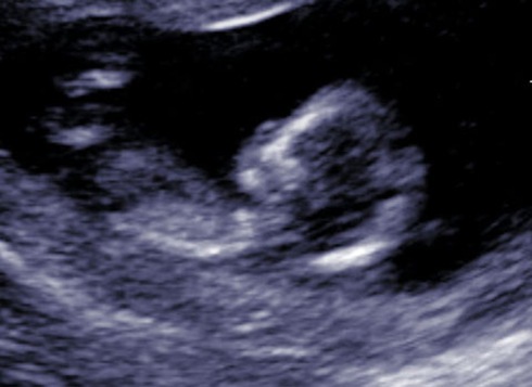 ultrasound01